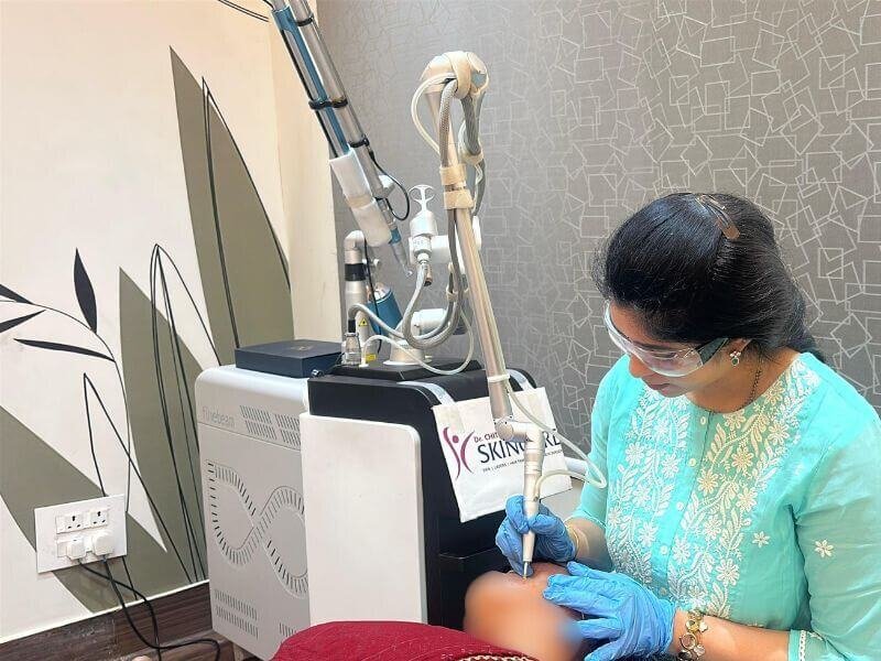 skintags moles dpn 2